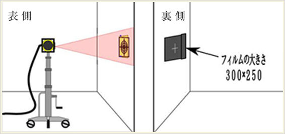 フィルムを貼り本照射をします